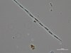 Photo of Pseudo-nitzschia spp. (large-celled)